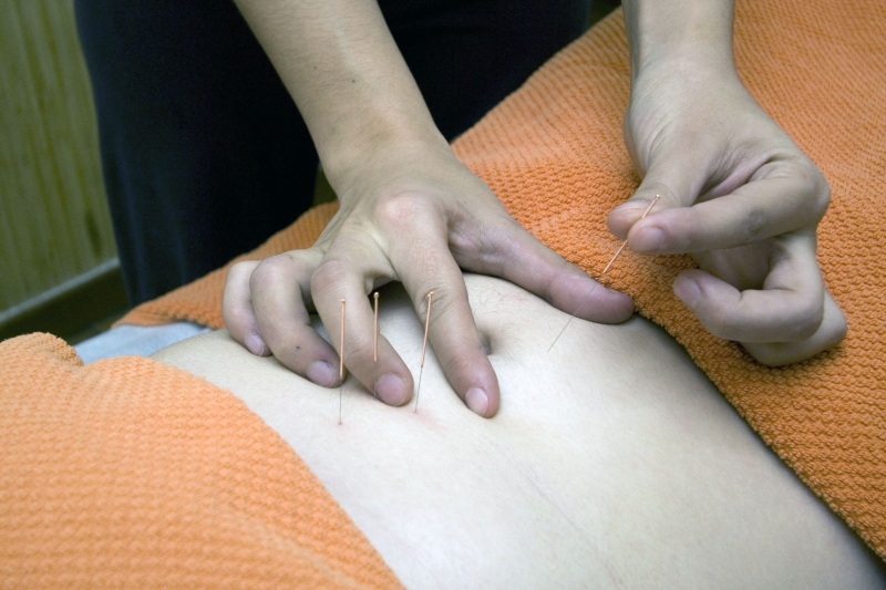 osteopathe-MONTFERRAT-min_acupuncture-4175625